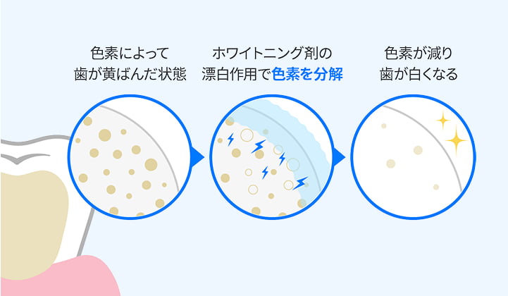 医療ホワイトニングの仕組みイラスト